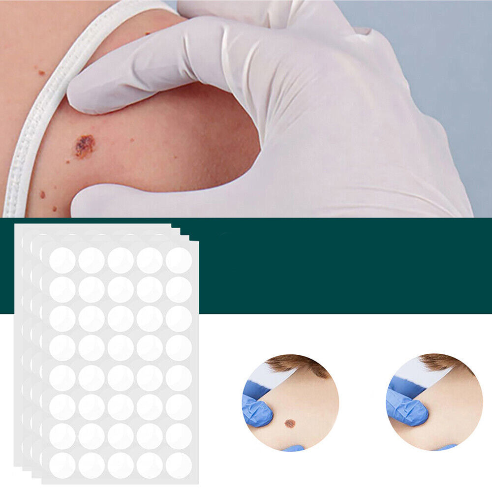 Gentle Skin Tag and Blemish Patches for Discreet Daily Spot Care